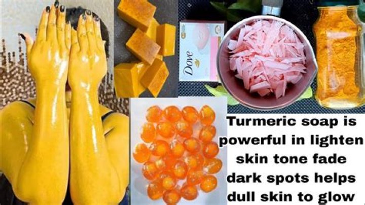 How turmeric helps pimples and black spots?