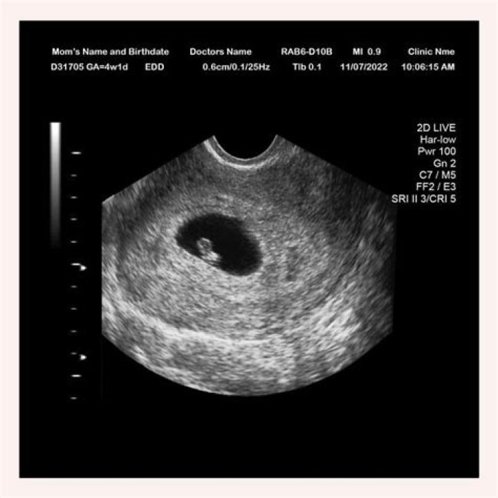 Is 4 weeks too early to tell parents we're pregnant?