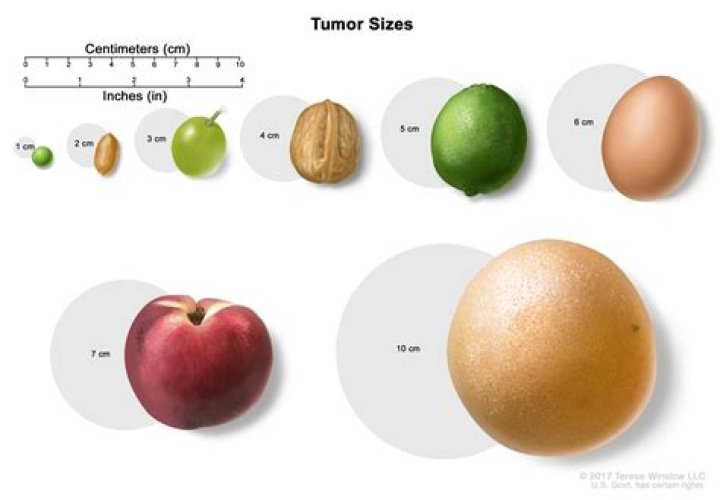Is a 5 mm tumor big?
