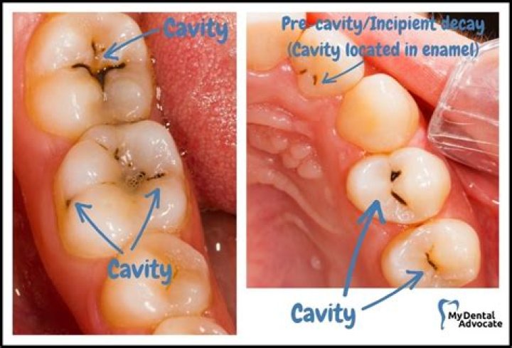 Is a cavity black?