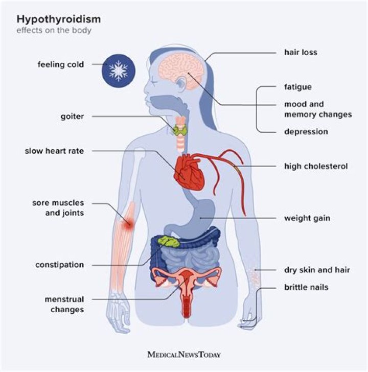 Is beets good for hypothyroidism?