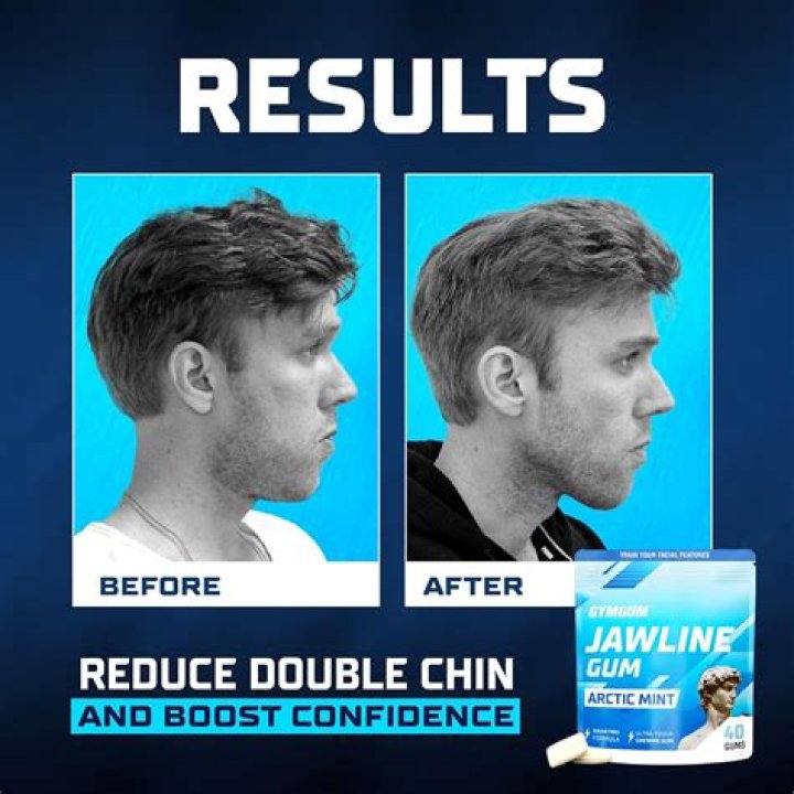 Is chewing gum good for double chin?