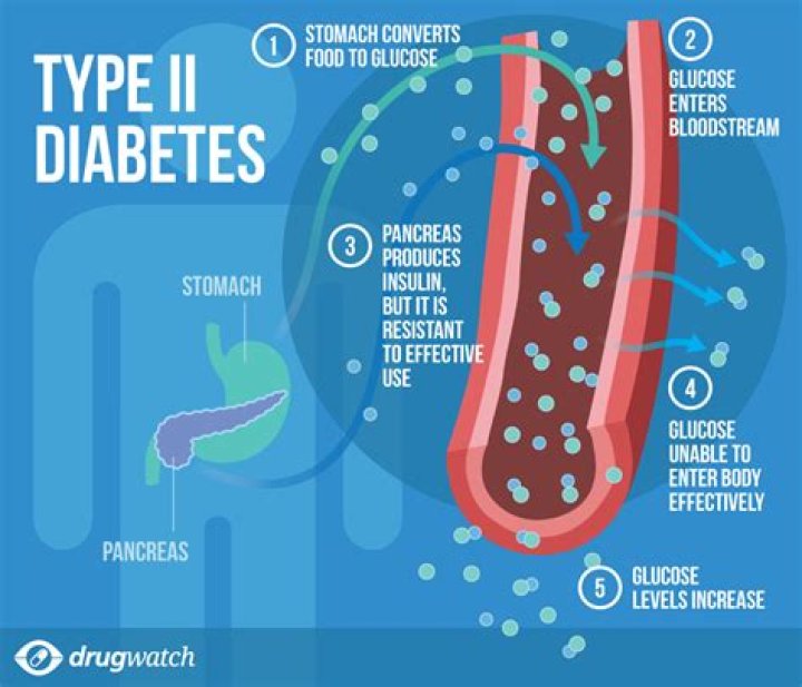 Is Diabetes Type 2 curable?