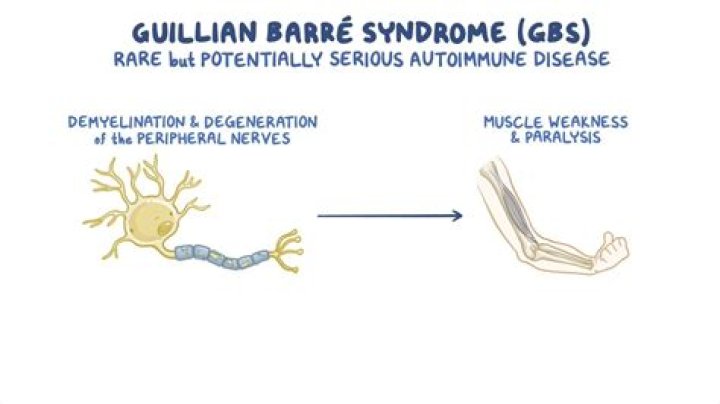 Is Guillain Barre the same as ALS?