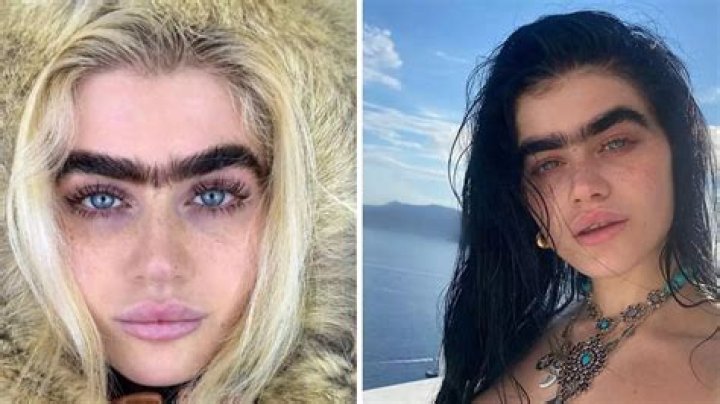 Is having a unibrow normal?