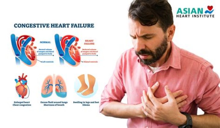 Is heart failure urgent?