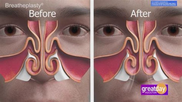 Is it harder to breathe on a plane?
