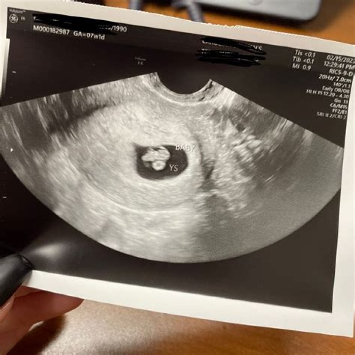 Is it normal to not feel anything at 7 weeks pregnant?
