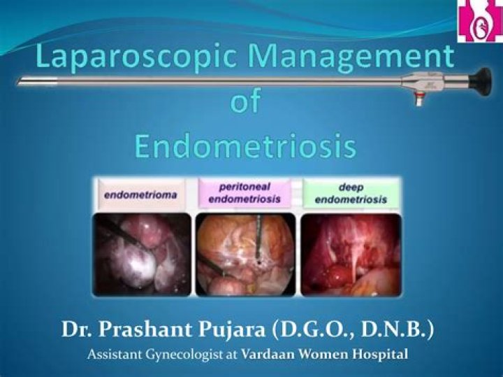 Is it worth having a laparoscopy for endometriosis?