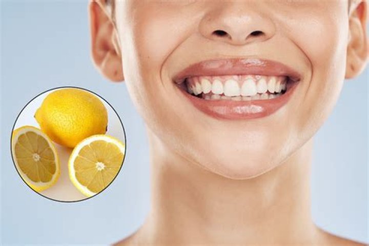 Is lemon good for teeth?