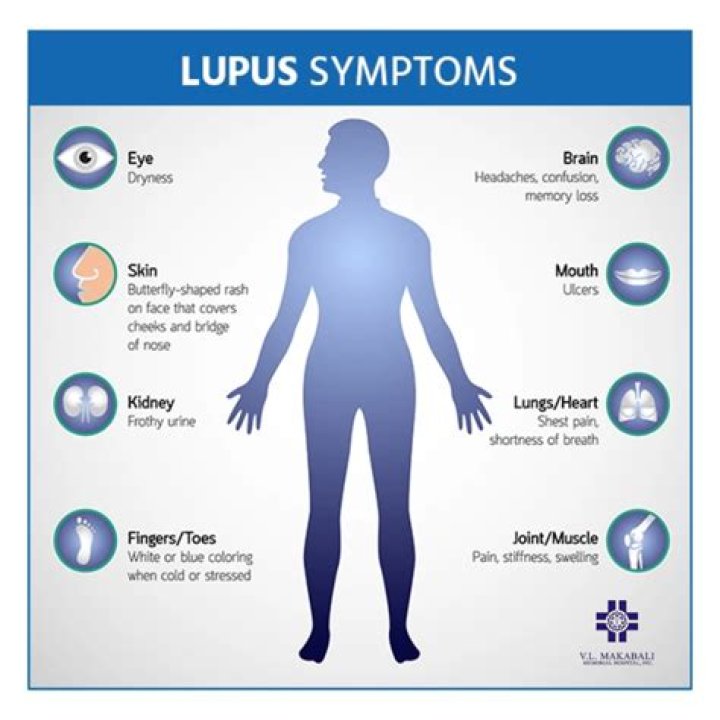 Is lupus caused by parasites?