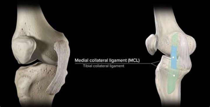 Is MCL on outside of knee?