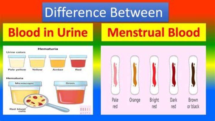 Is menstrual blood sterile?