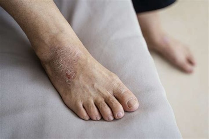 Is PebbleTec hard on your feet?