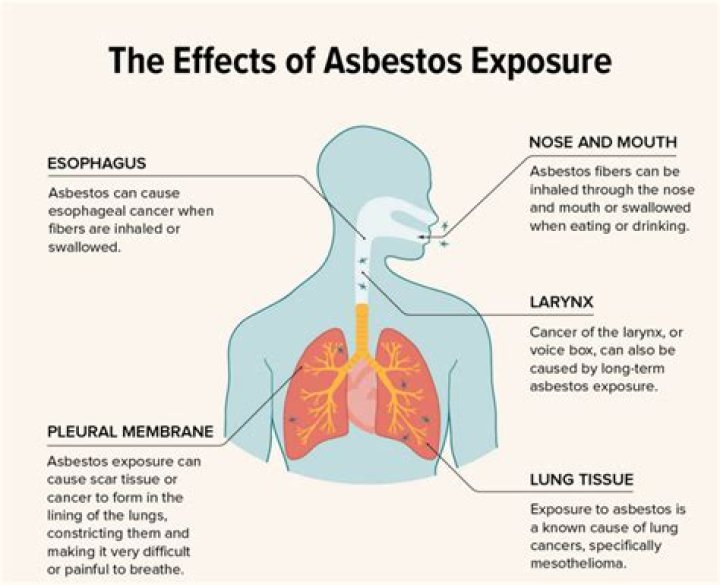 Is there a cure for asbestos in the lungs?
