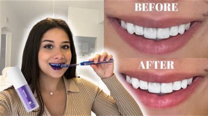 Is there a toothpaste that really whitens teeth?