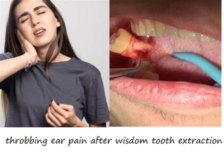 Is throbbing tooth pain an emergency?