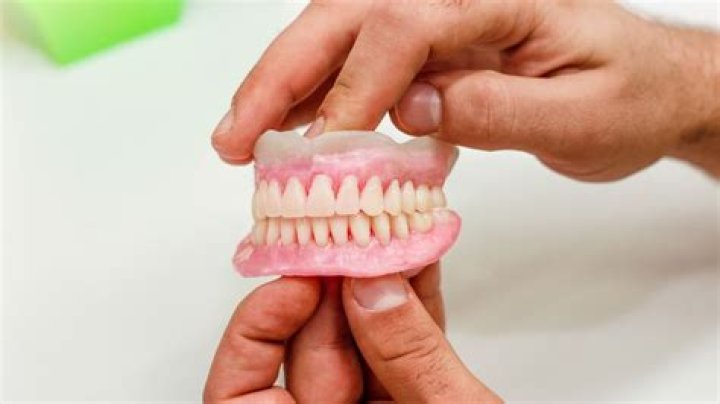 Should dentures fit tight?