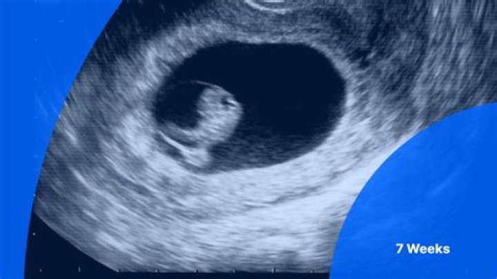 Should I see a doctor at 5 weeks pregnant?