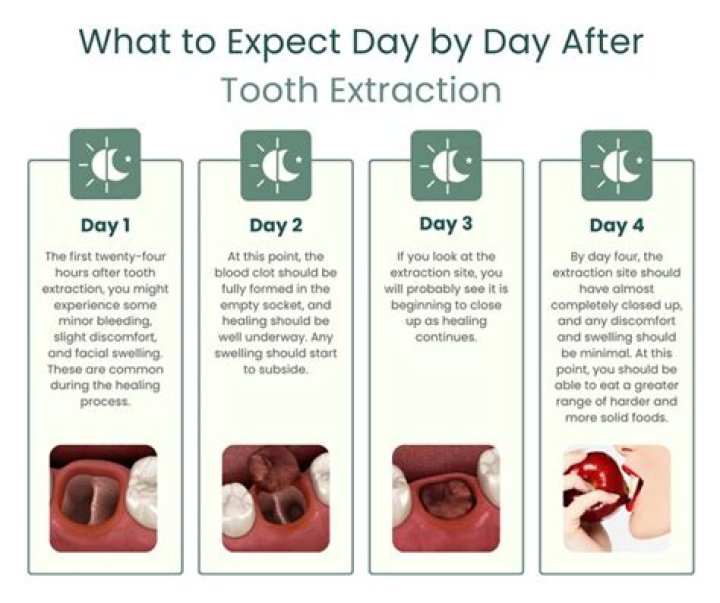 Should I take a day off work after tooth extraction?