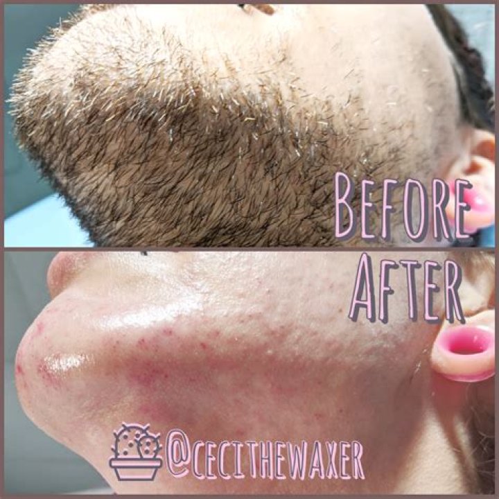 Should I trim my back hair before waxing?
