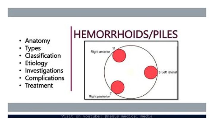 Should you put heat on hemorrhoids?