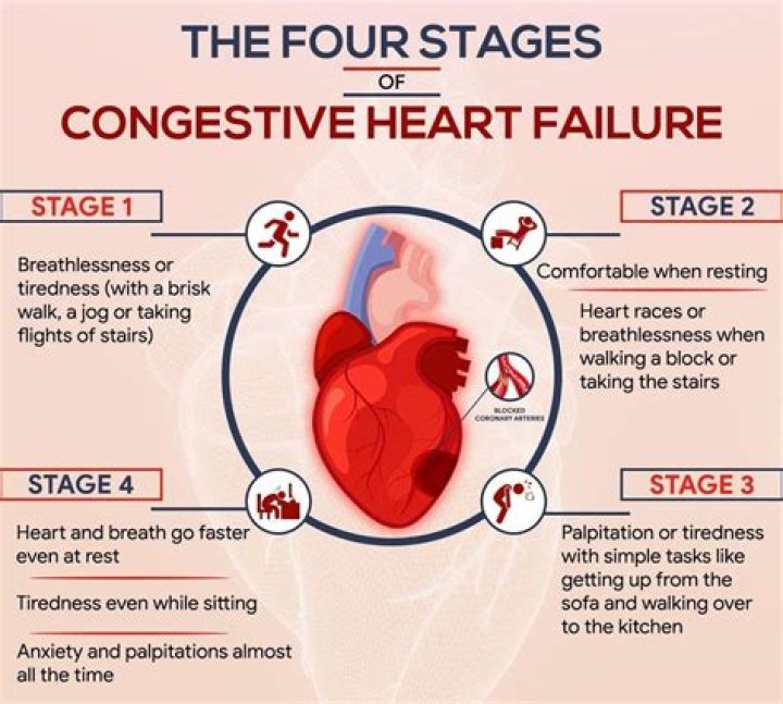 What are the 4 signs of heart failure?