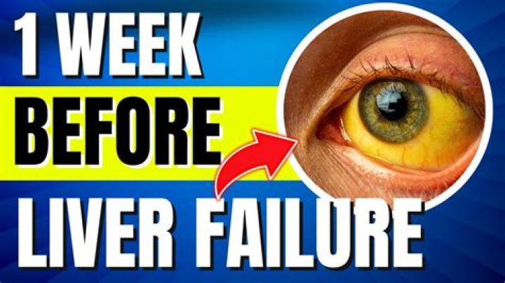 What are the last days of liver failure like?