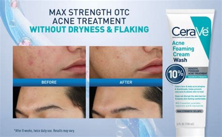 What are the side effects of CeraVe moisturizing cream?