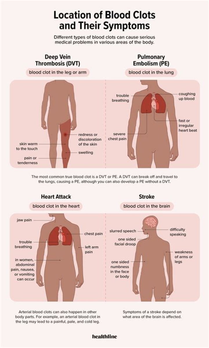 What are the symptoms of blood clots?