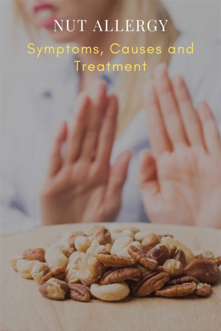 What are the symptoms of nut allergy?