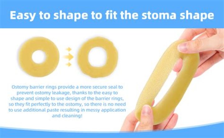 What are two major principles that should be followed to protect the skin around the stoma from irritation and breakdown?