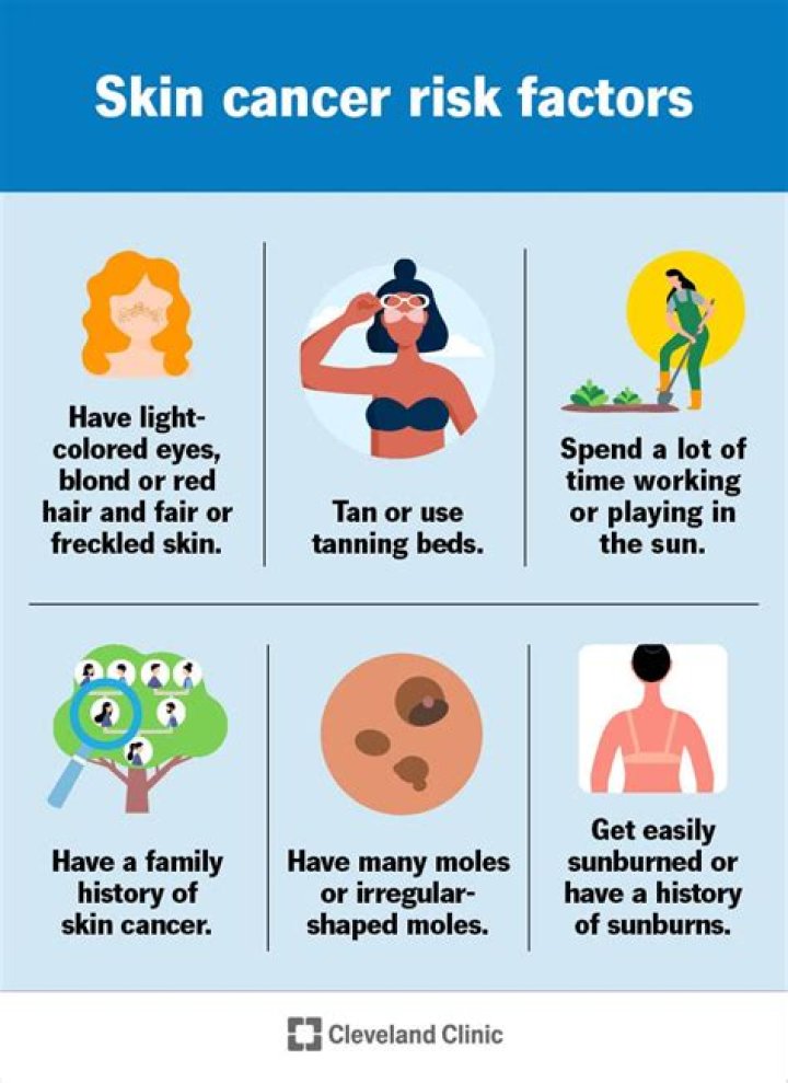 What causes fair skin?