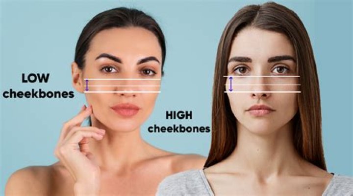 What causes low cheekbones?