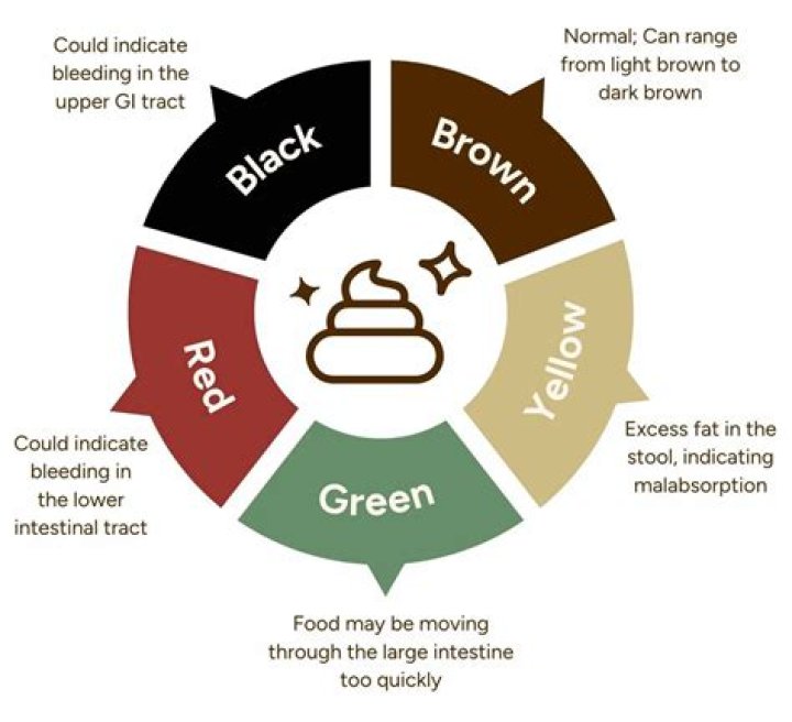 What color poop indicates a problem?