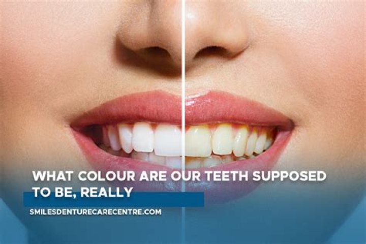 What Colour are teeth naturally?
