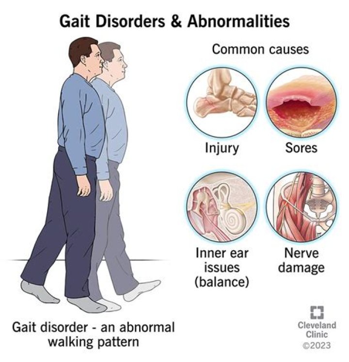 What diseases cause difficulty in walking?