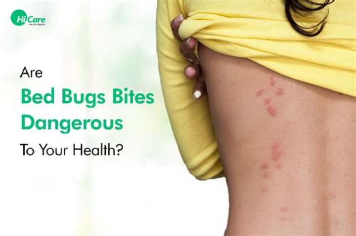 What do Bedbug bites look like when they first appear?