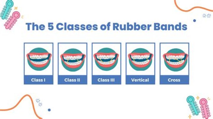 What do Class 3 rubber bands do?
