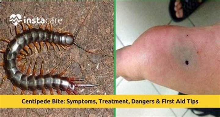 What does a house centipede bite look like?