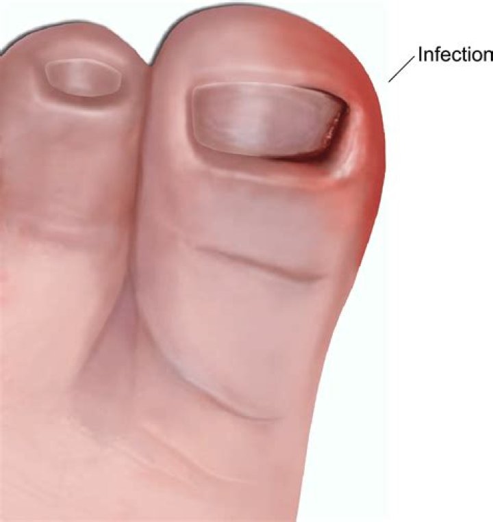 What does an infected joint feel like?