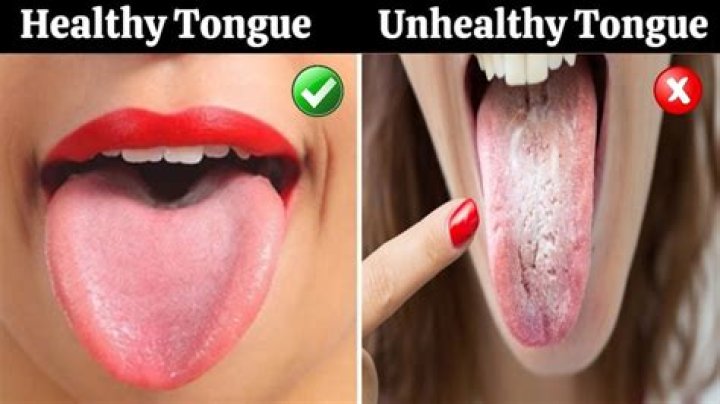 What does an unhealthy tongue look like?