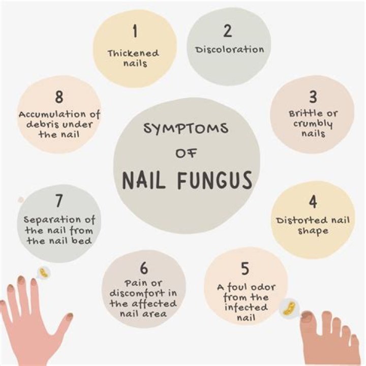 What does eye fungus look like?