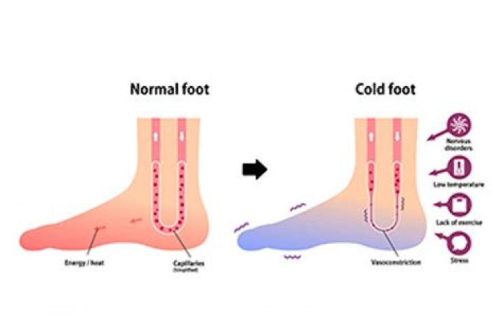 What does having cold feet mean?