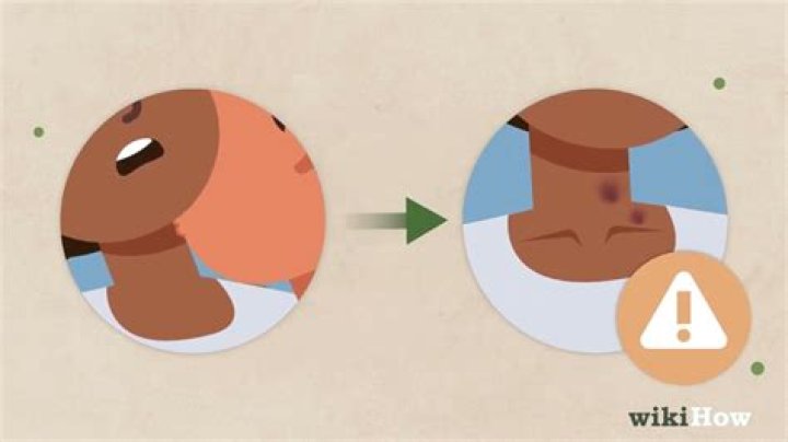 What does it mean when a guy puts a hickey on your neck?