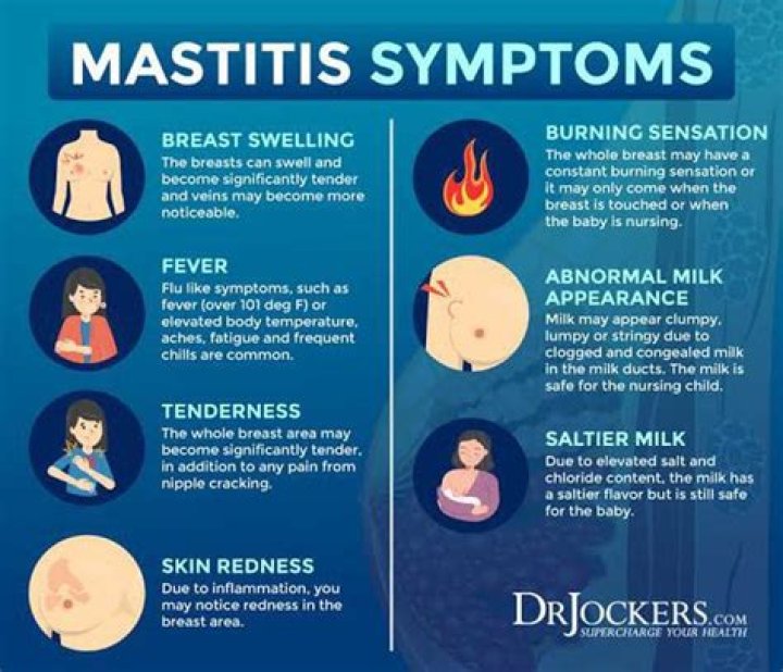 What does mastitis look like?