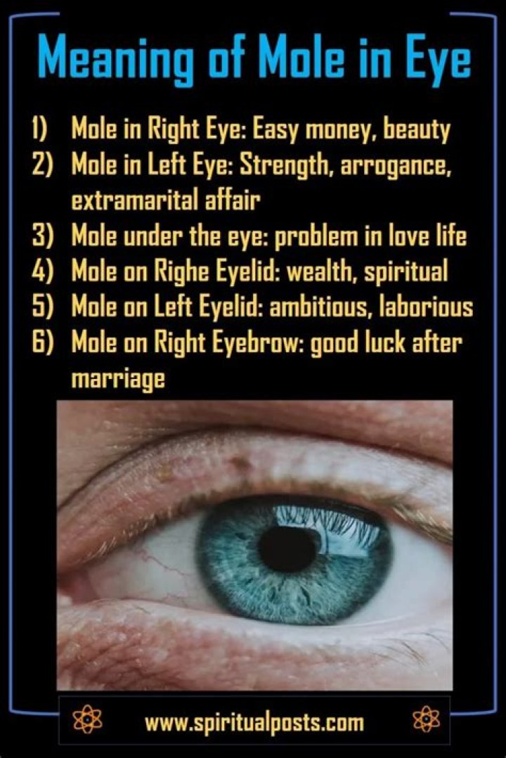 What does mole in right eye mean?