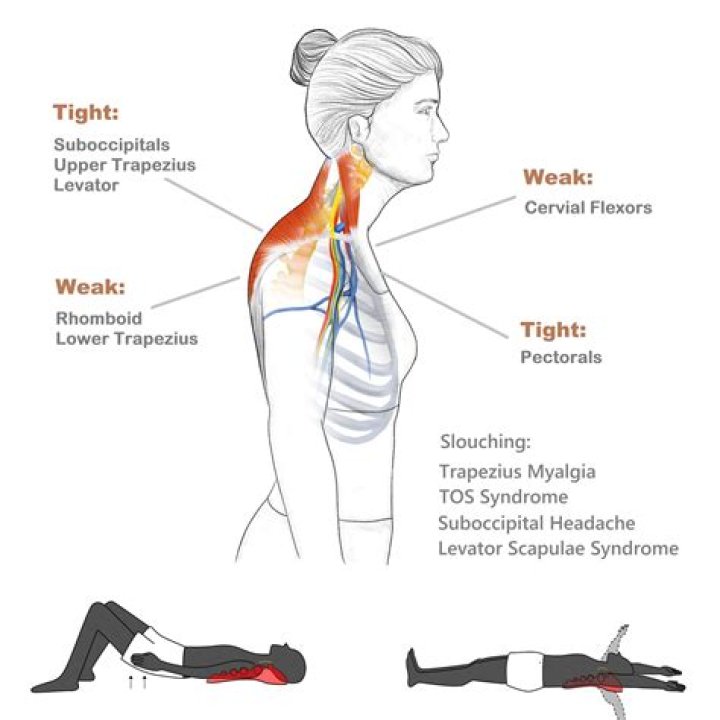 What does MS pain feel like in legs?