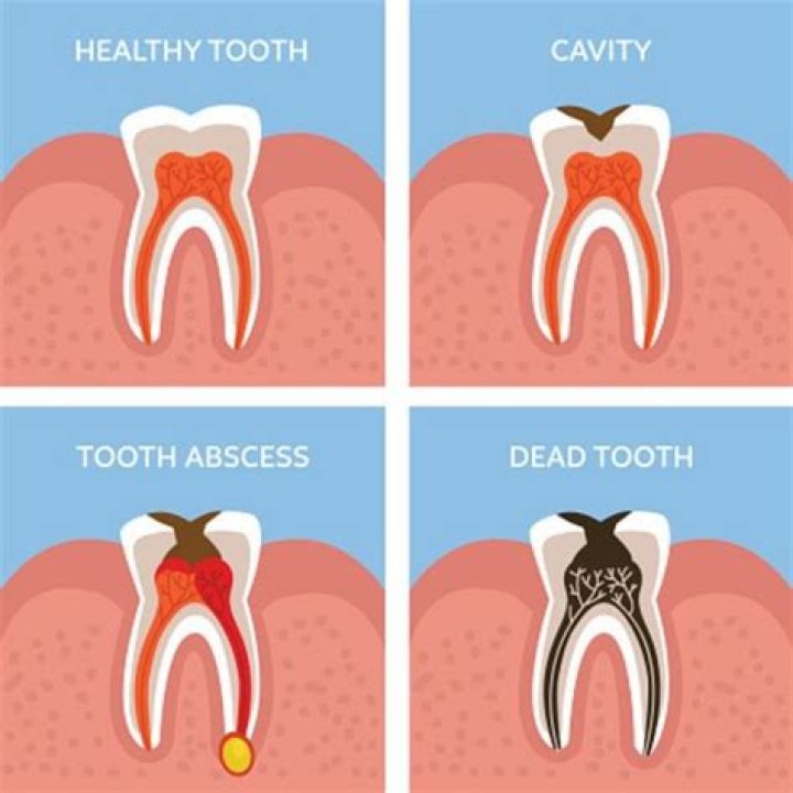 What does tooth infection feel like?