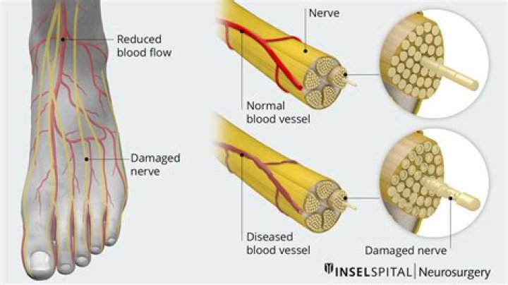 What happens if nerves get damaged?